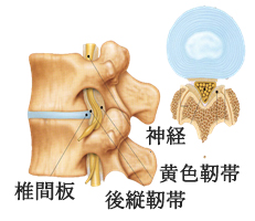 腰痛症